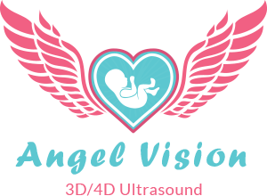 Angel Vision