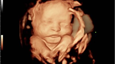 0F640594-2808-4AB0-93D2-3ED08E50E9DF 0F640594-2808-4AB0-93D2-3ED08E50E9DF