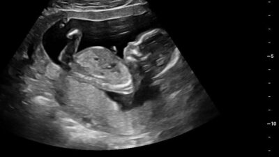 2E116B9A-28CC-46DE-B34F-4DC35F5109A3 2E116B9A-28CC-46DE-B34F-4DC35F5109A3